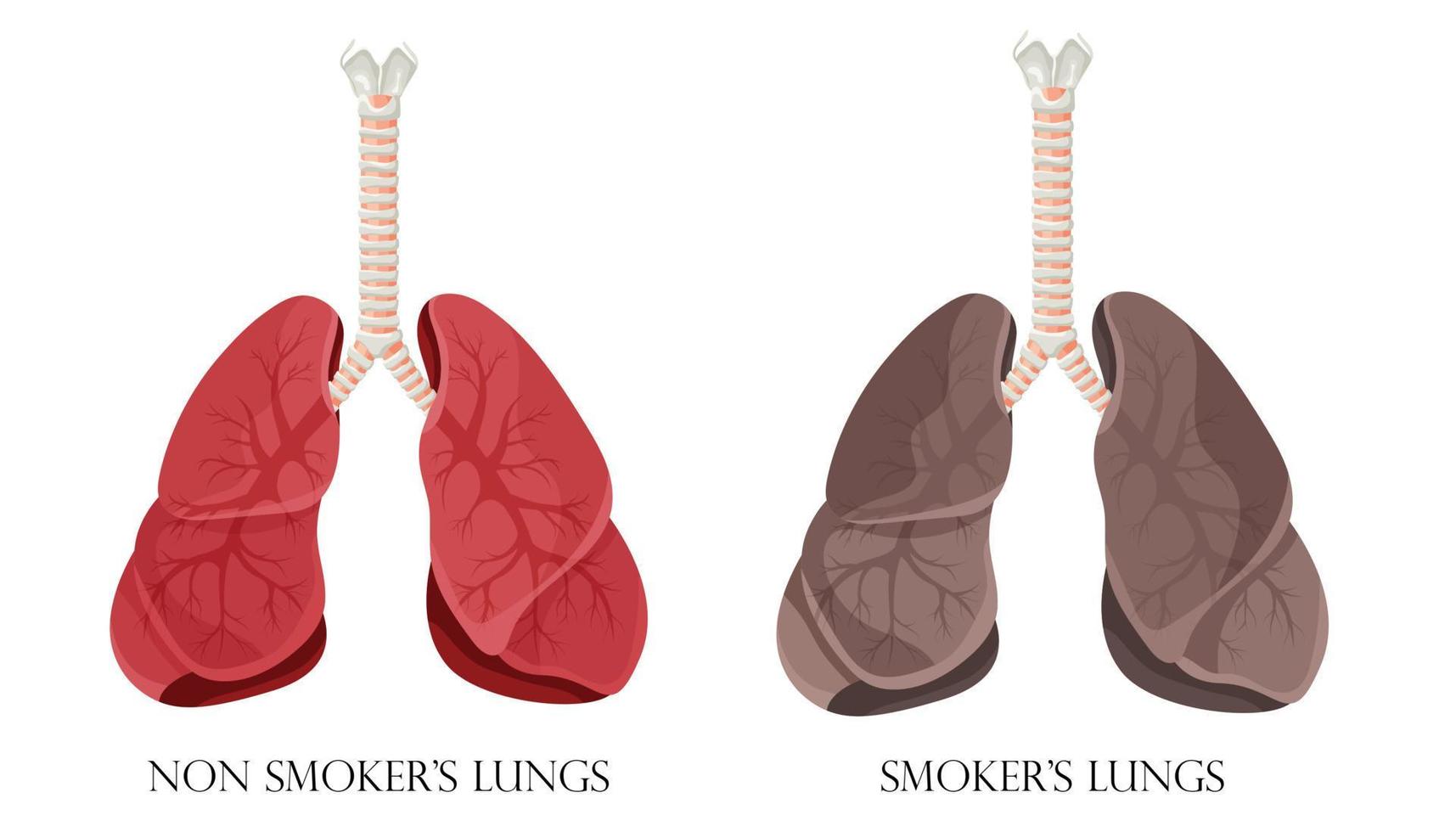 Illustration of normal healthy lungs and lungs smoker. Concept of stop smoking. Vector illustration.