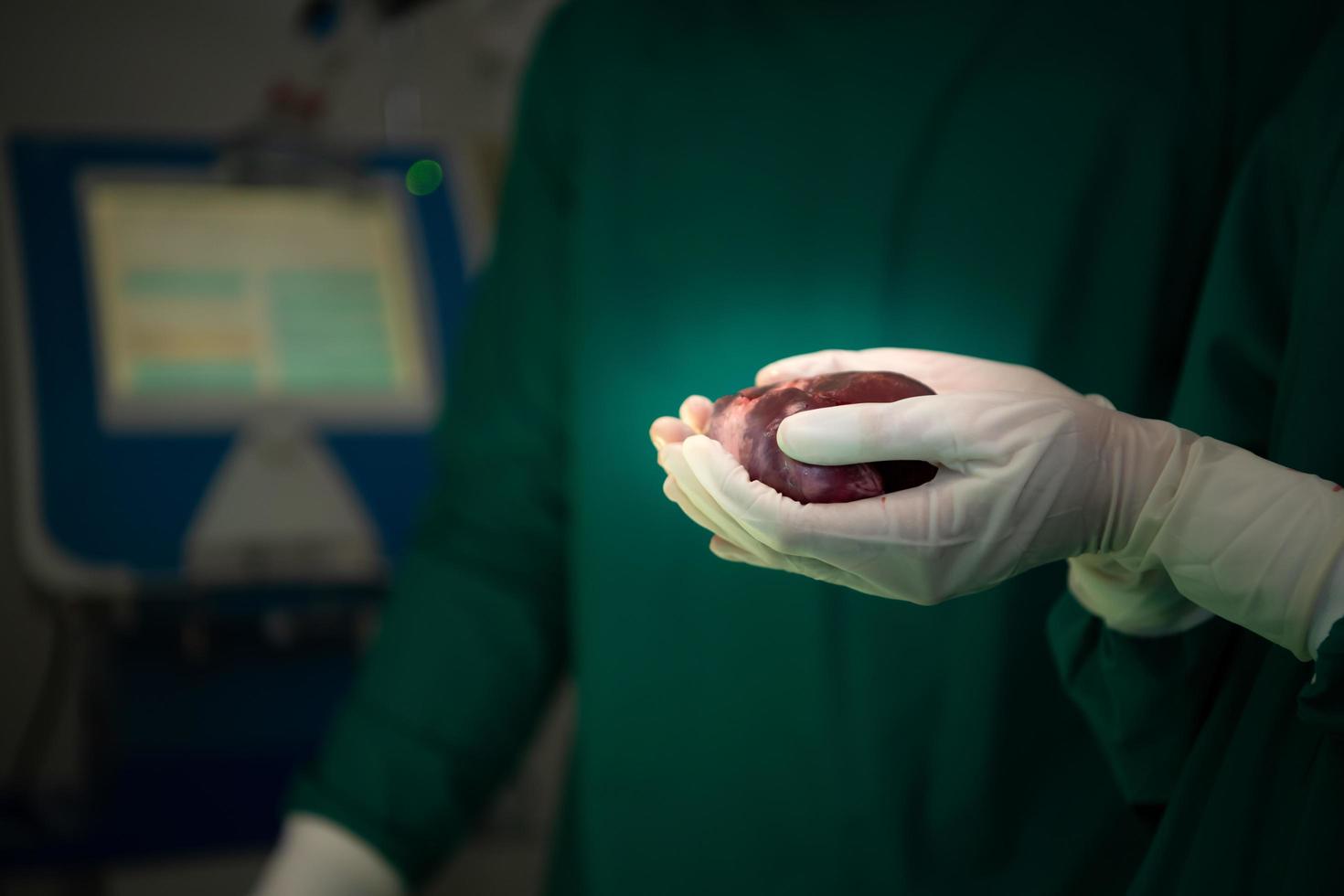 Professor of medicine in cardiology and a team of doctors in the operating room undergoing heart transplant surgery photo