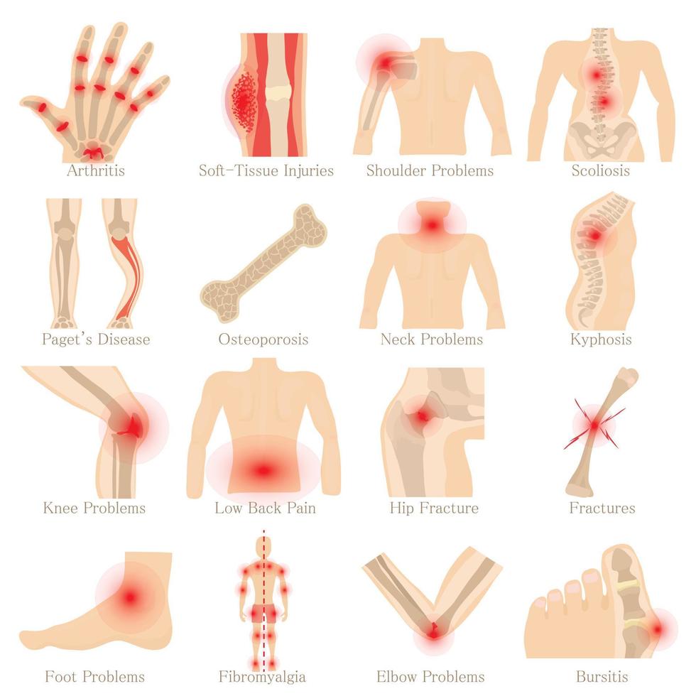 Orthopedic diseases icons set, cartoon style vector