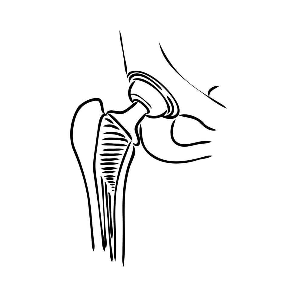 dibujo vectorial de la articulación de la cadera vector