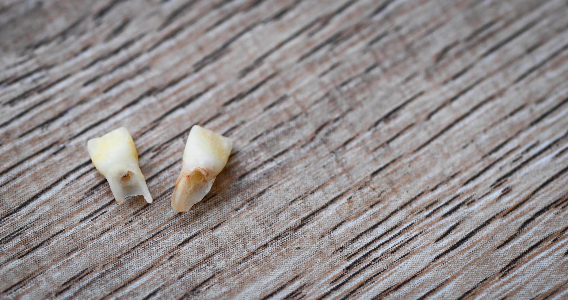 Diente de leche, cerrar los dientes de leche de la pérdida de dientes en madera, concepto de problemas de salud dental de dientes de leche foto