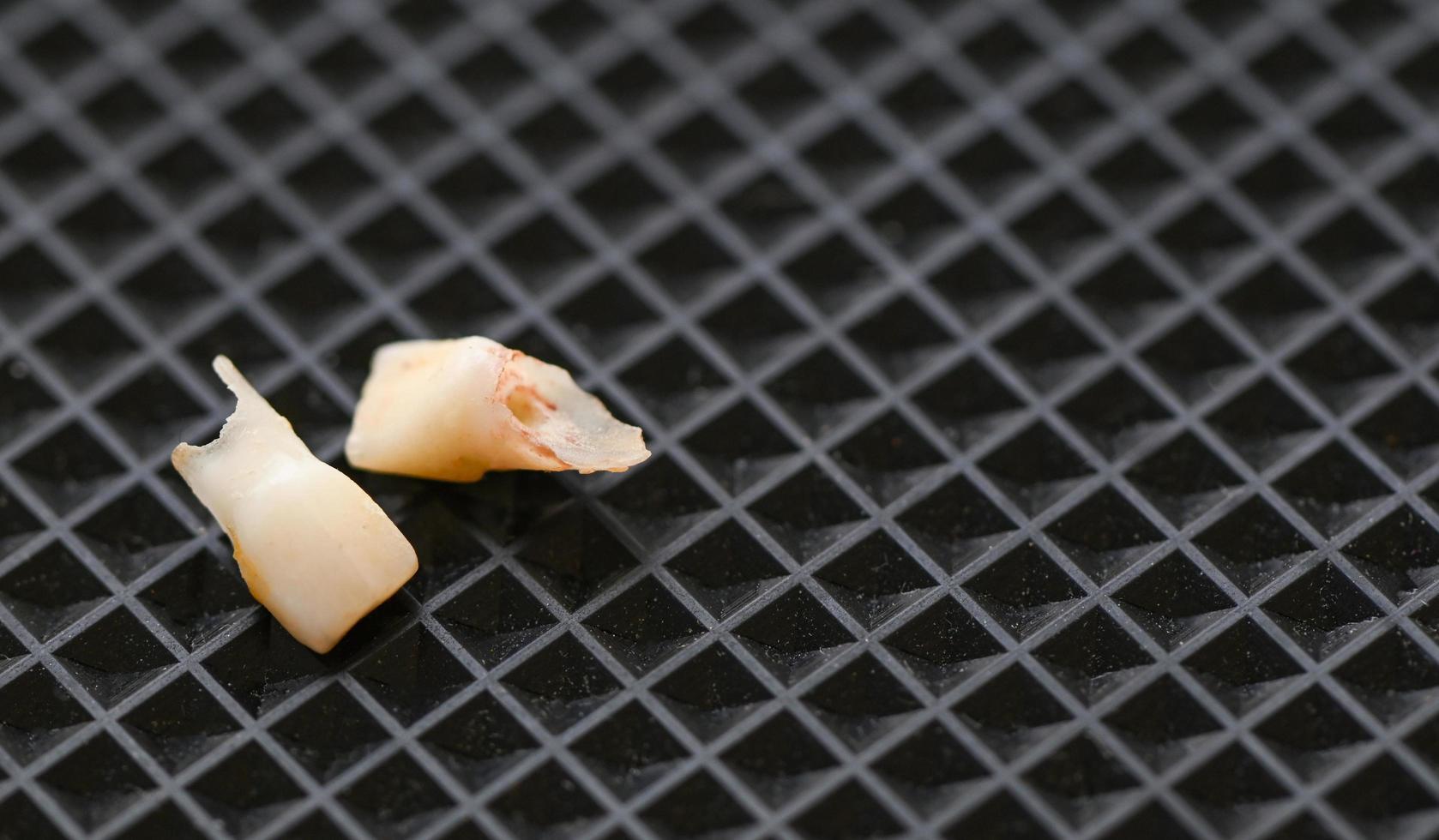 Milk tooth , Close up baby teeth of tooth loss on dark background , milk tooth dental health problems concept photo