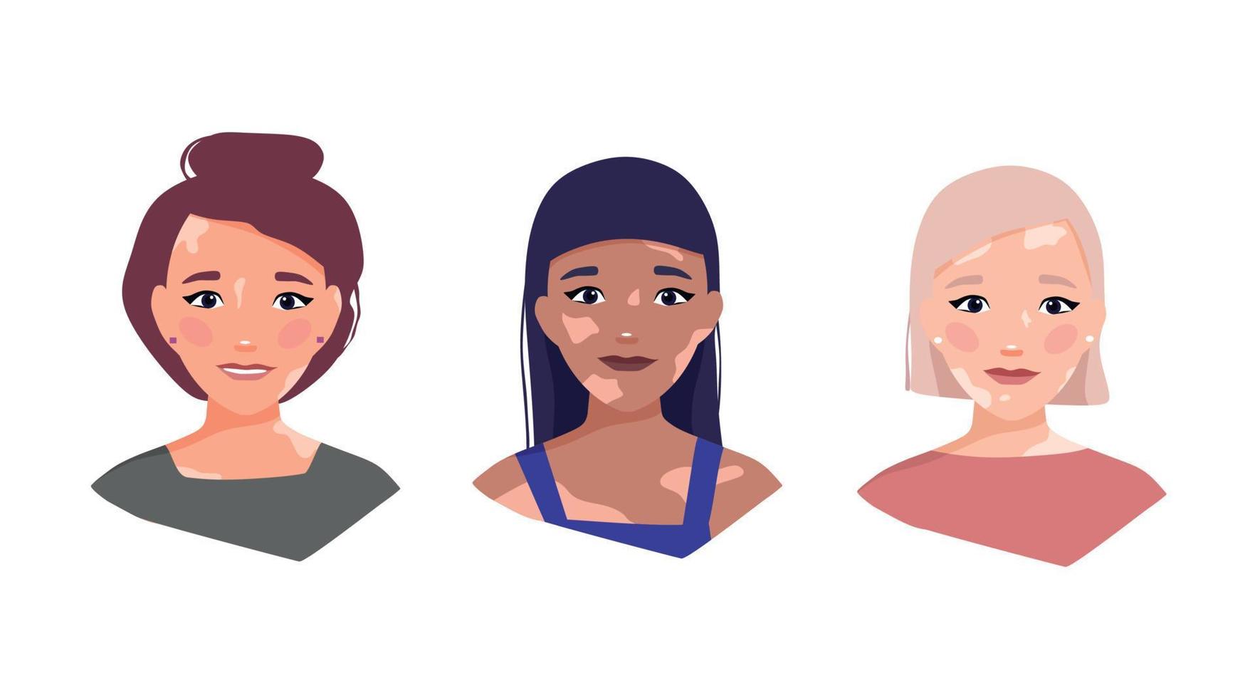 Girls with Vitiligo. The concept of different beauty, body positivity, self-acceptance. Skin disease. Vector cartoon illustration
