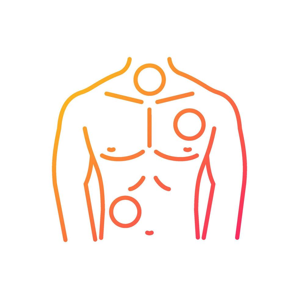 Metastases gradient linear vector icon. Chest cancer. Thorax and lungs tumors. Spreading of cancer. Pathogenic cells. Thin line color symbol. Modern style pictogram. Vector isolated outline drawing