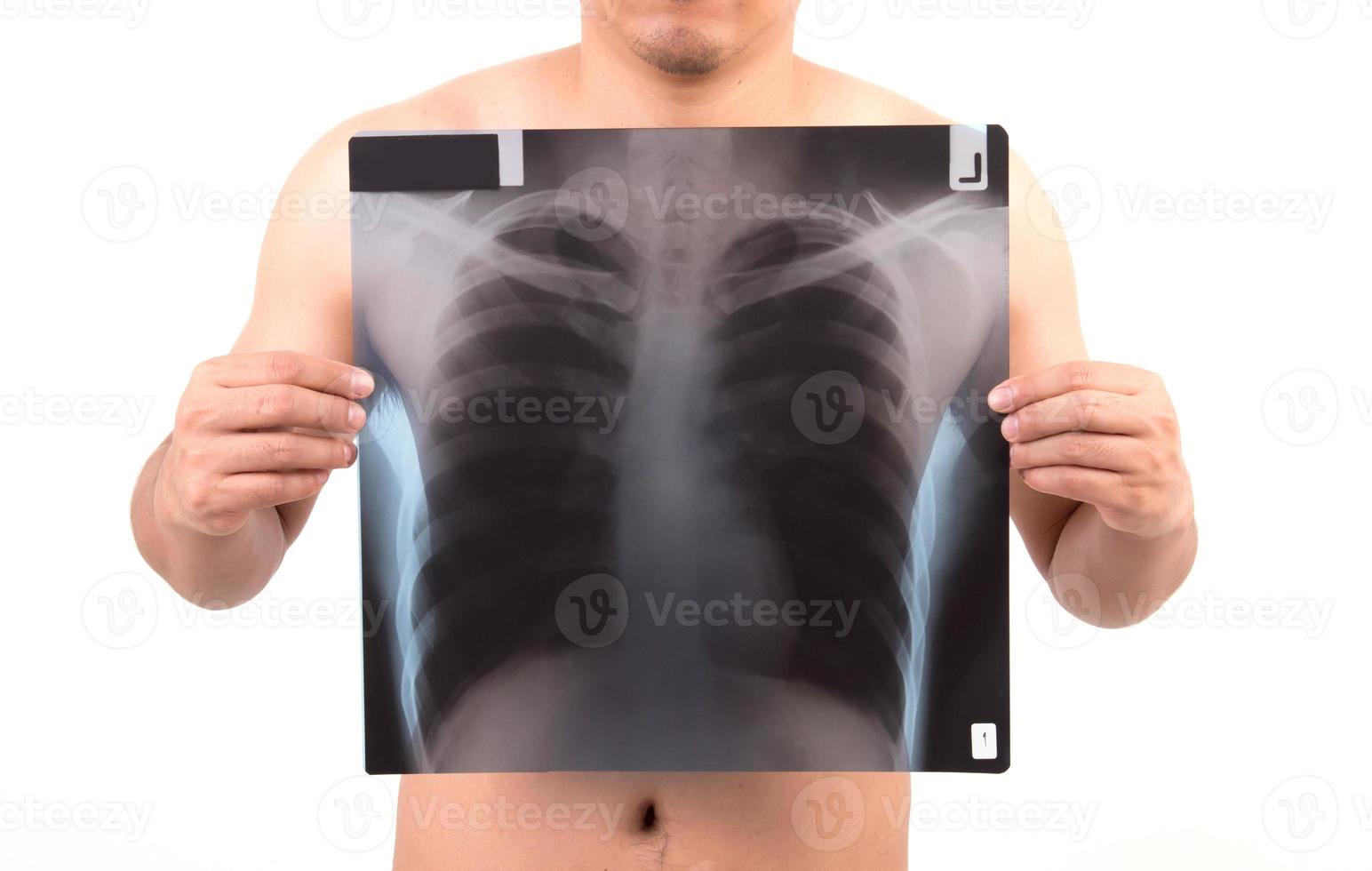 unidentify person showing x-ray film photo