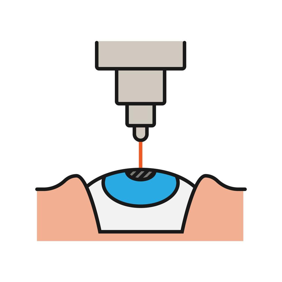 icono de color de cirugía ocular con láser. oftalmología médica. corrección de la visión con láser. ilustración vectorial aislada vector