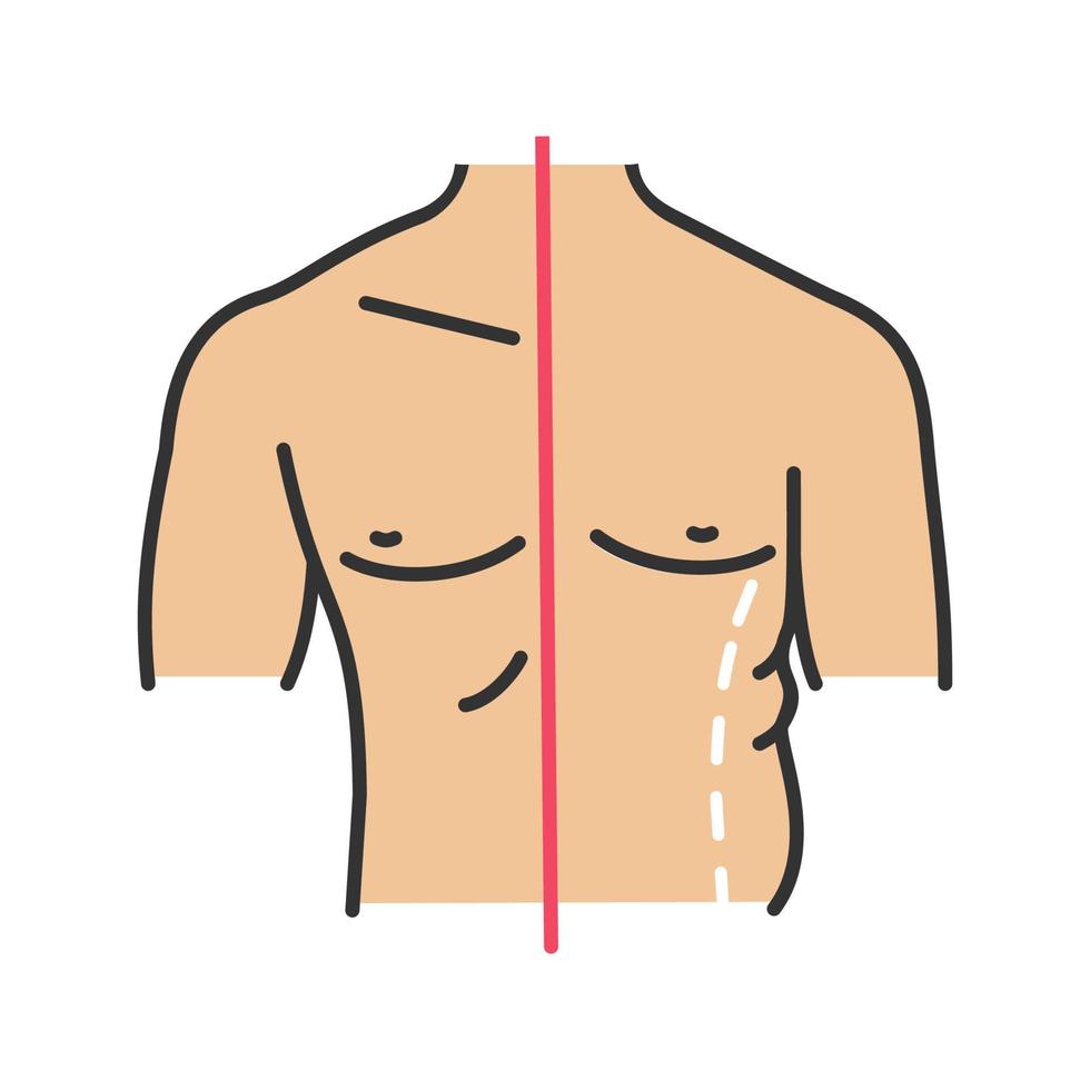 icono de color de escultura masculina. corrección de flancos. liposucción masculina y contorno corporal antes y después. operacion plastica. ilustración vectorial aislada vector