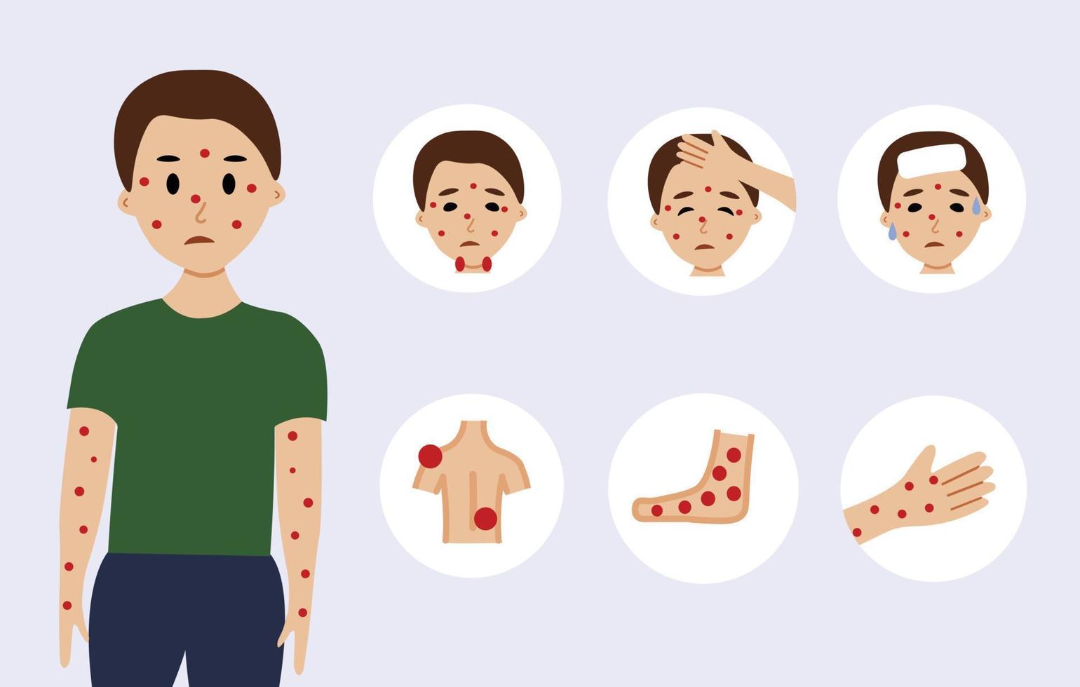 ilustración de síntomas del virus de la viruela del mono con carácter masculino. concepto de brote de viruela del mono por la organización mundial de la salud con ejemplos y explicación. vector