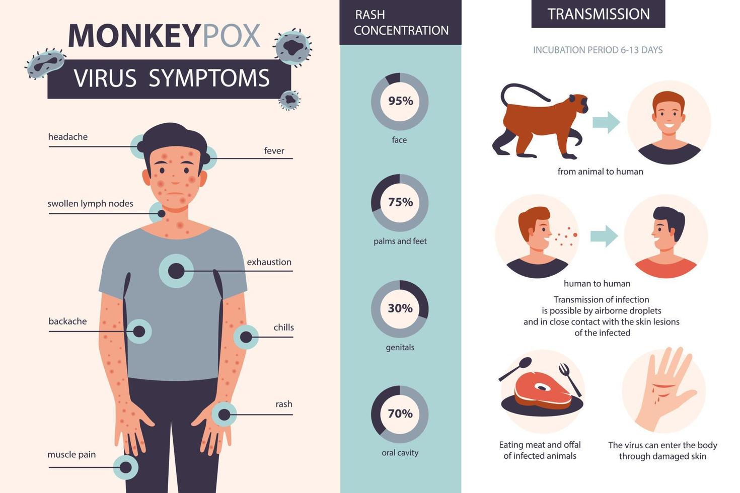 Monkey pox virus symptoms infographic. It cause skin infections. Headache, fever, rash in the patient. Flat vector illustration