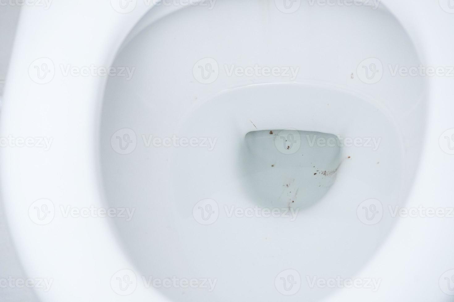 Black stain in the toilet bowl. photo
