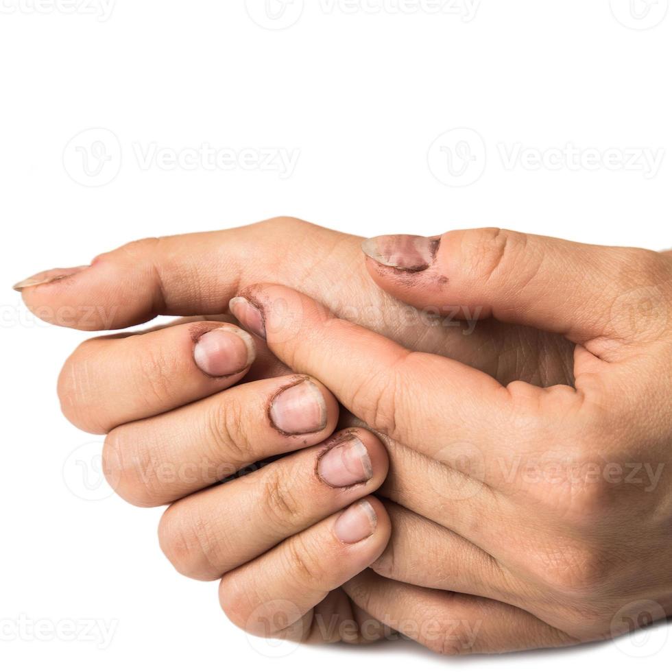 Female hands with dirty nails photo