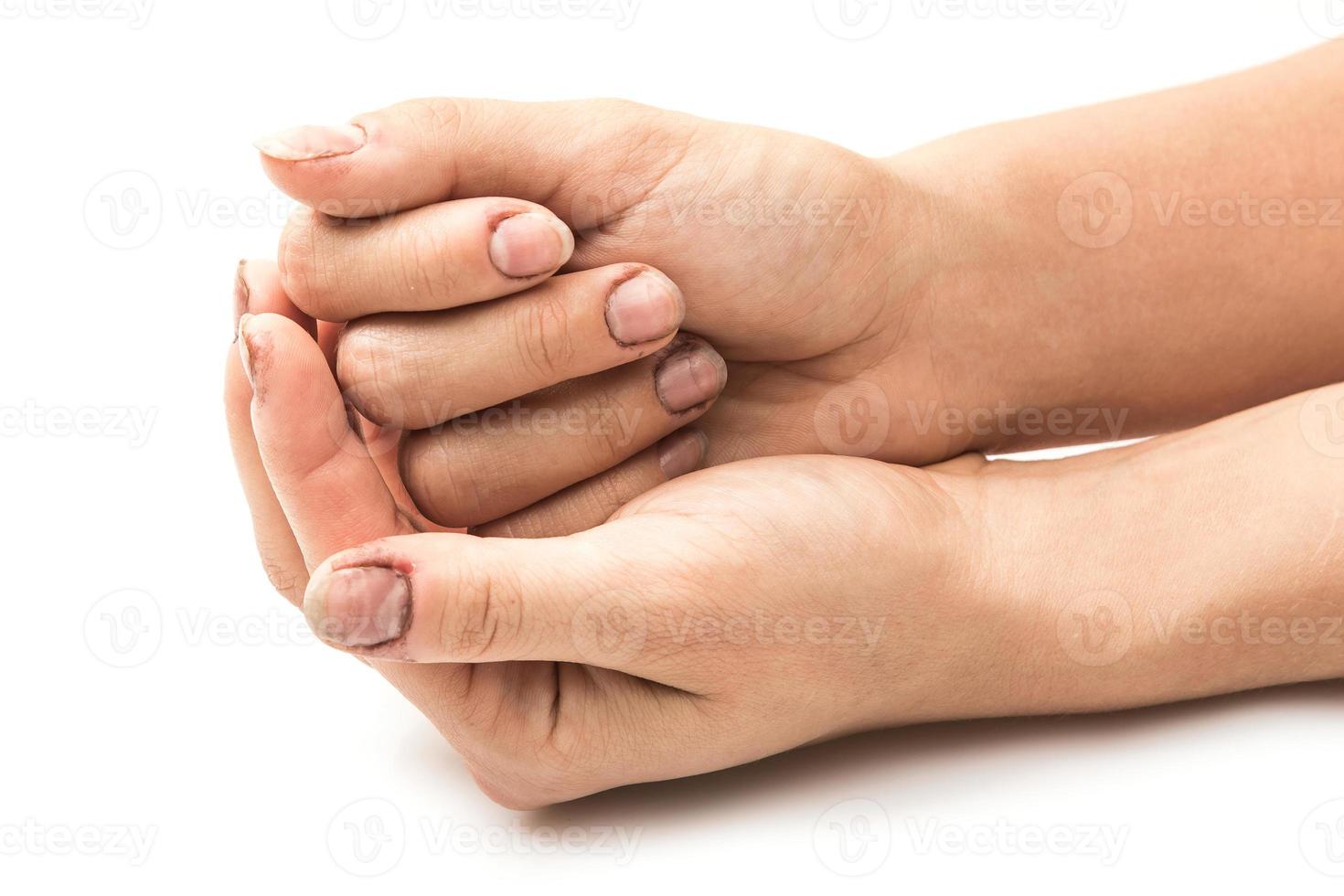 Female hands with dirty nails photo