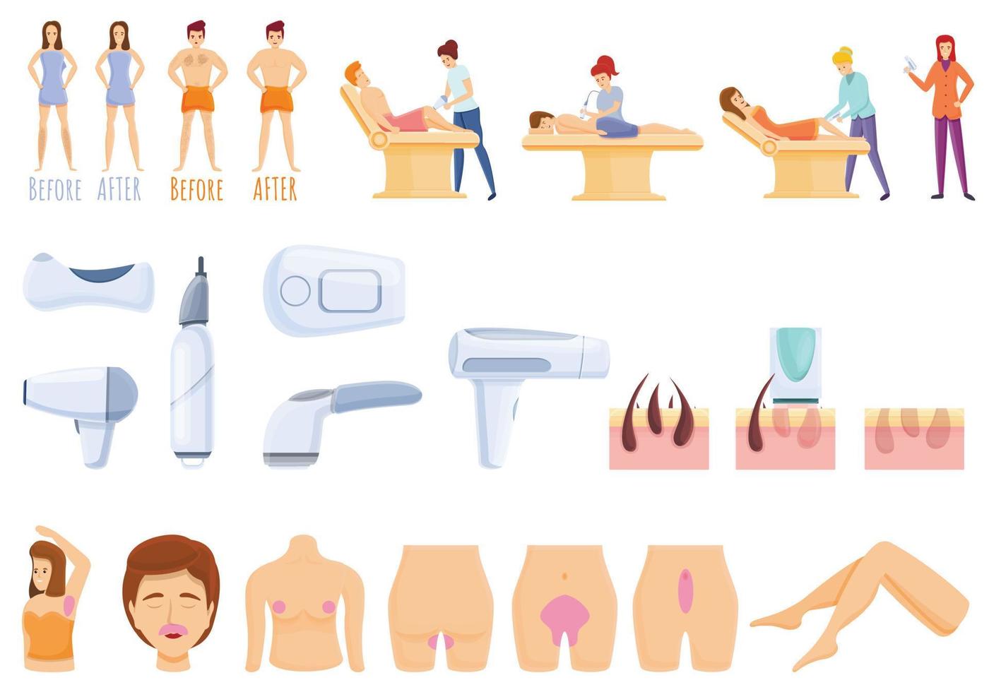 Laser hair removal icons set, cartoon style vector