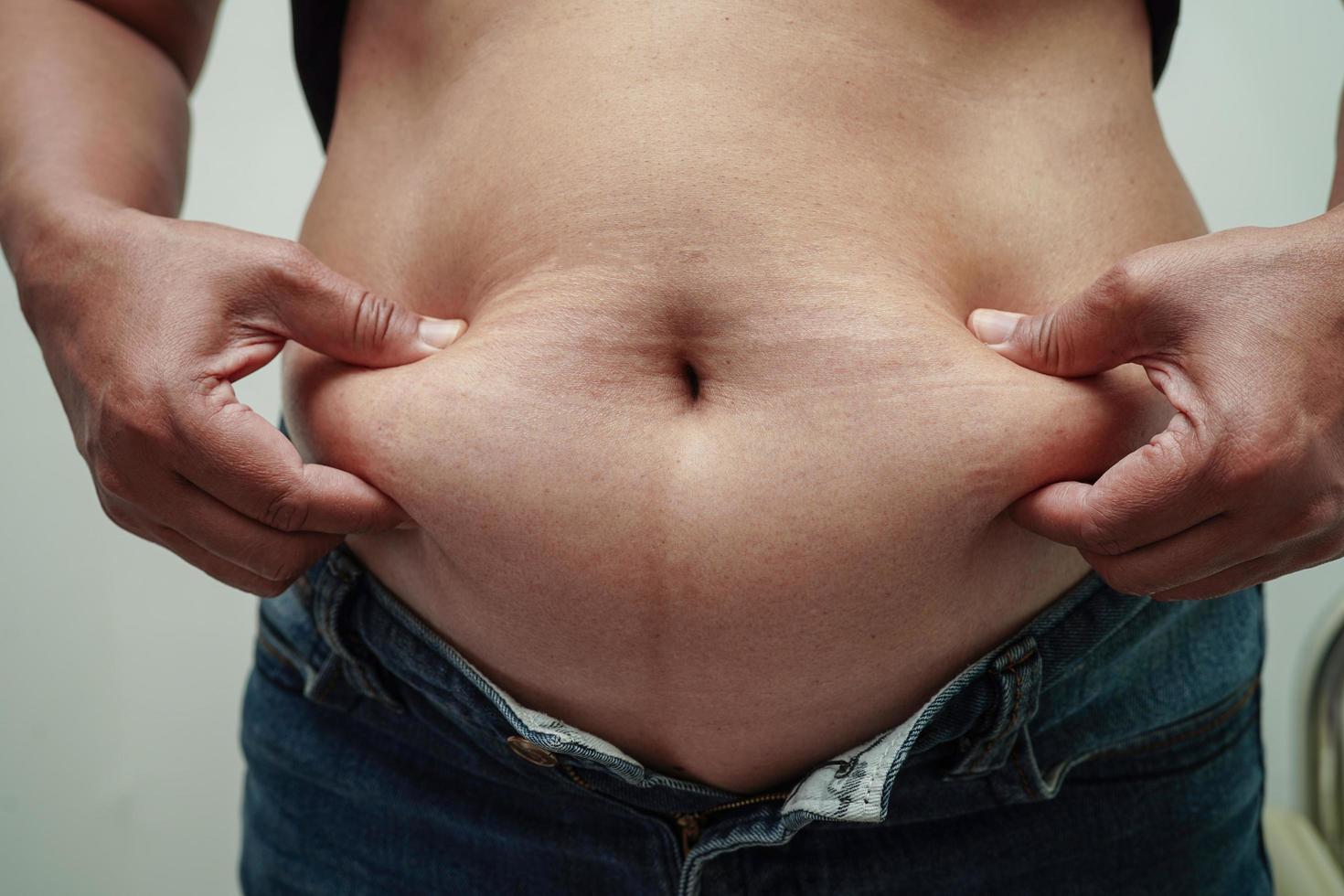 mujer asiática con sobrepeso usa la mano para apretar el vientre gordo de gran tamaño con sobrepeso y obesidad. foto