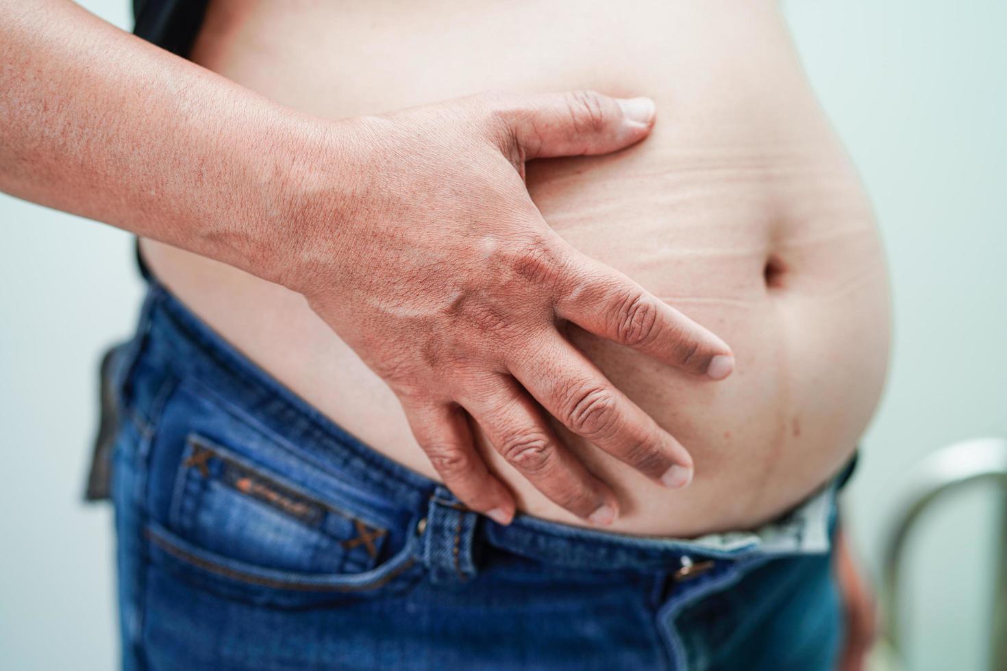 Asian woman show fat belly big size overweight and obesity at office. photo