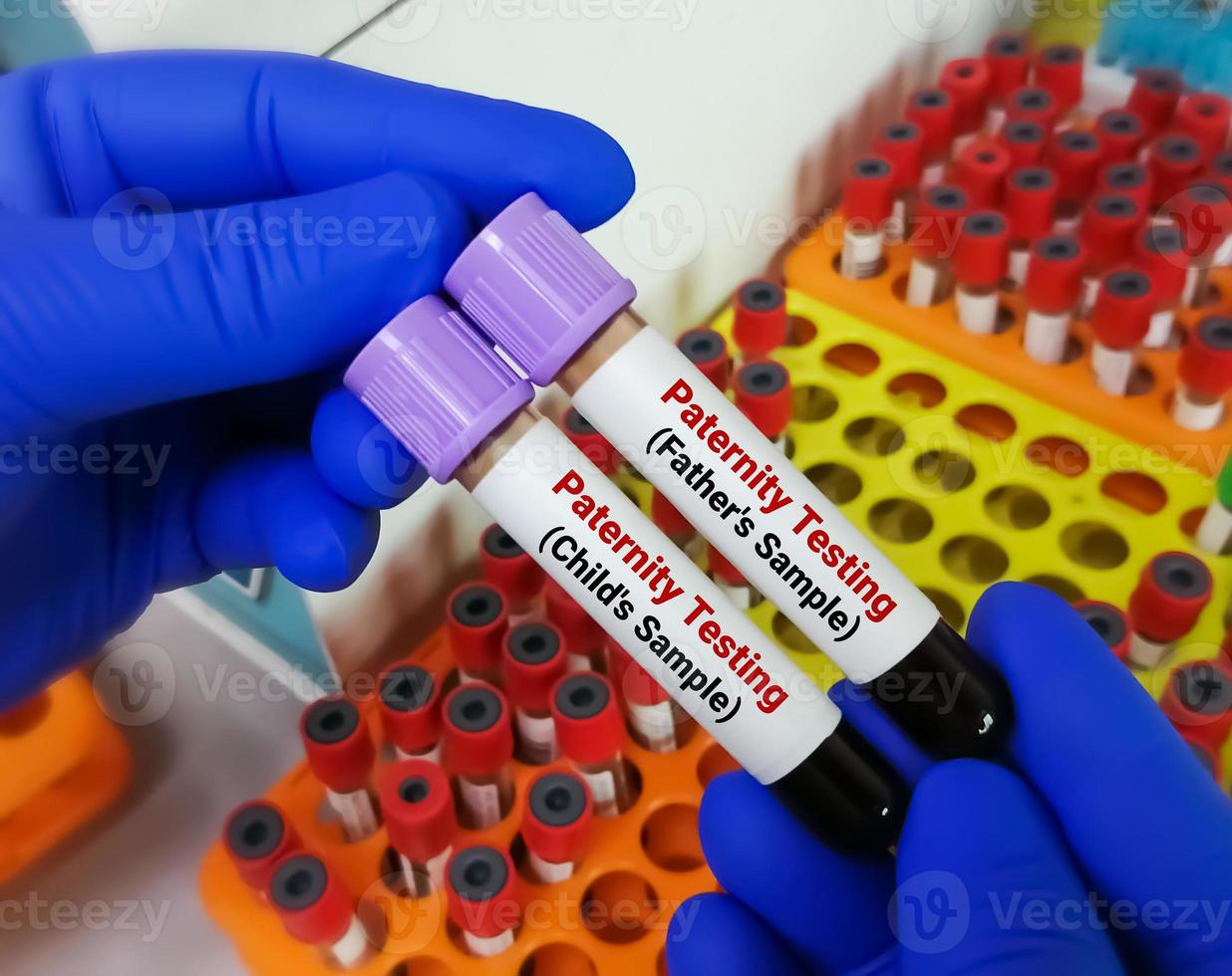 Paternity testing by DNA sequencing of Father's and children's blood sample. photo