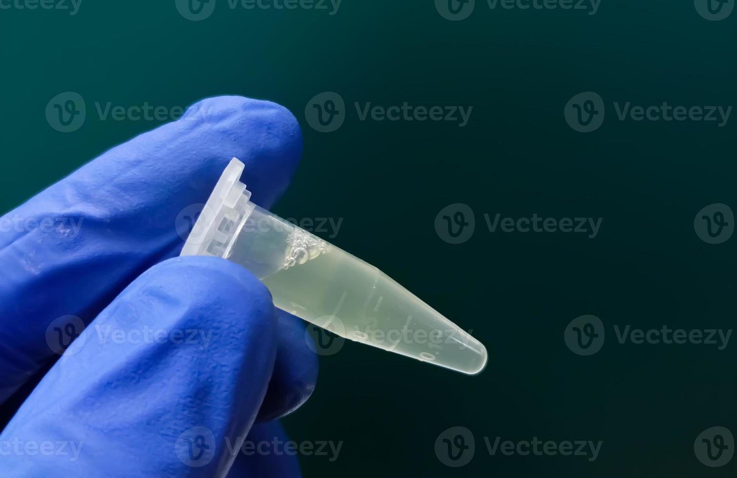 Eppendorf Tube with Cerebrospinal fluid or CSF sample for pathological study including biochemistry, cytology, Gram staining. photo
