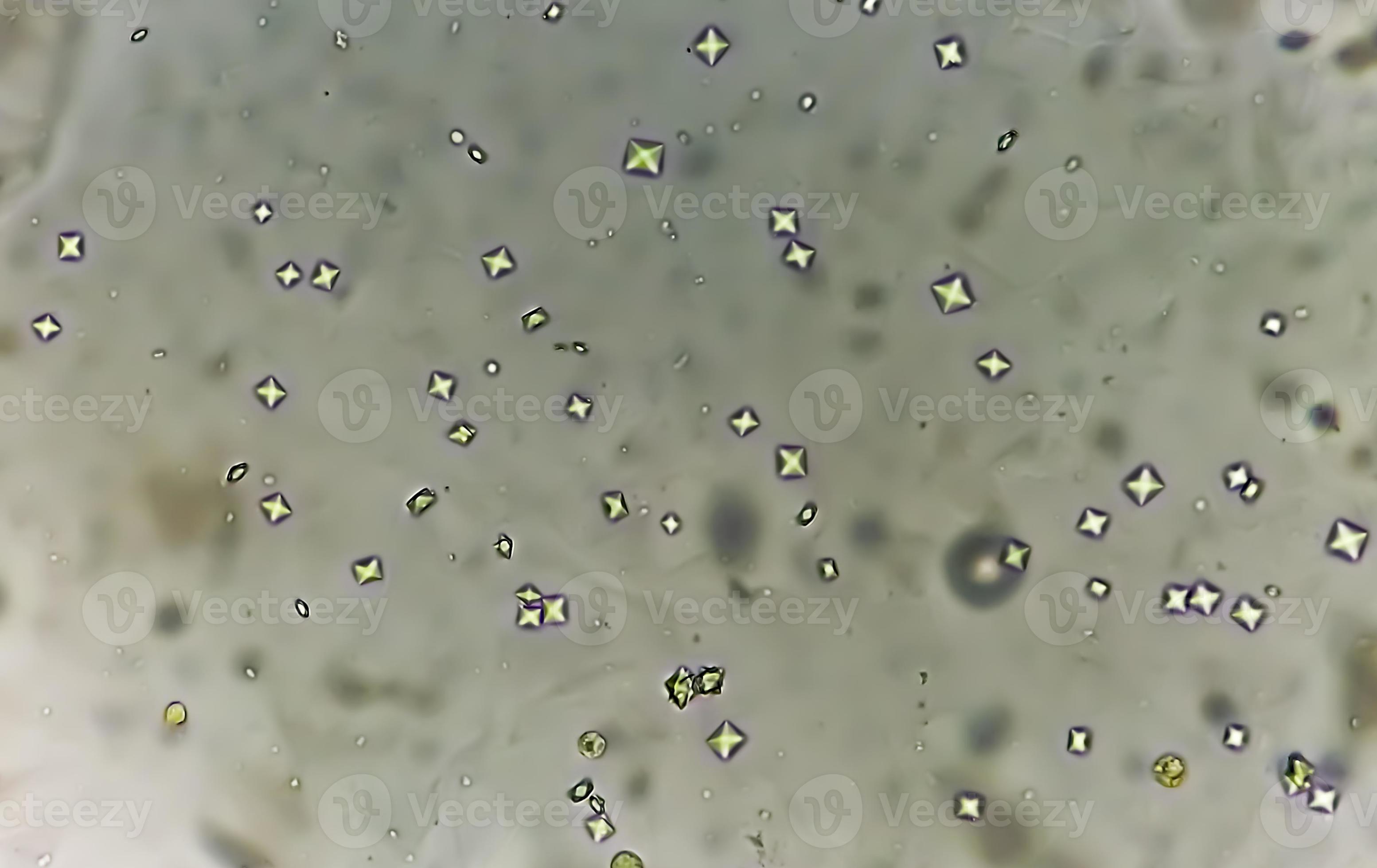 Calcium oxalate crystal from urine sediment. 8930976 Stock Photo at