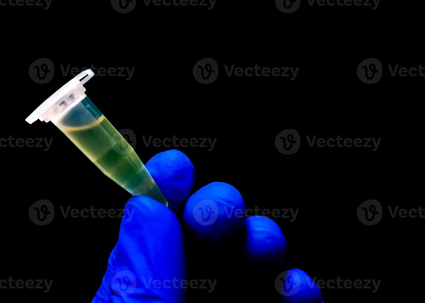 Eppendorf Tube with Cerebrospinal fluid or CSF sample for pathological study including biochemistry, cytology, Gram staining. photo
