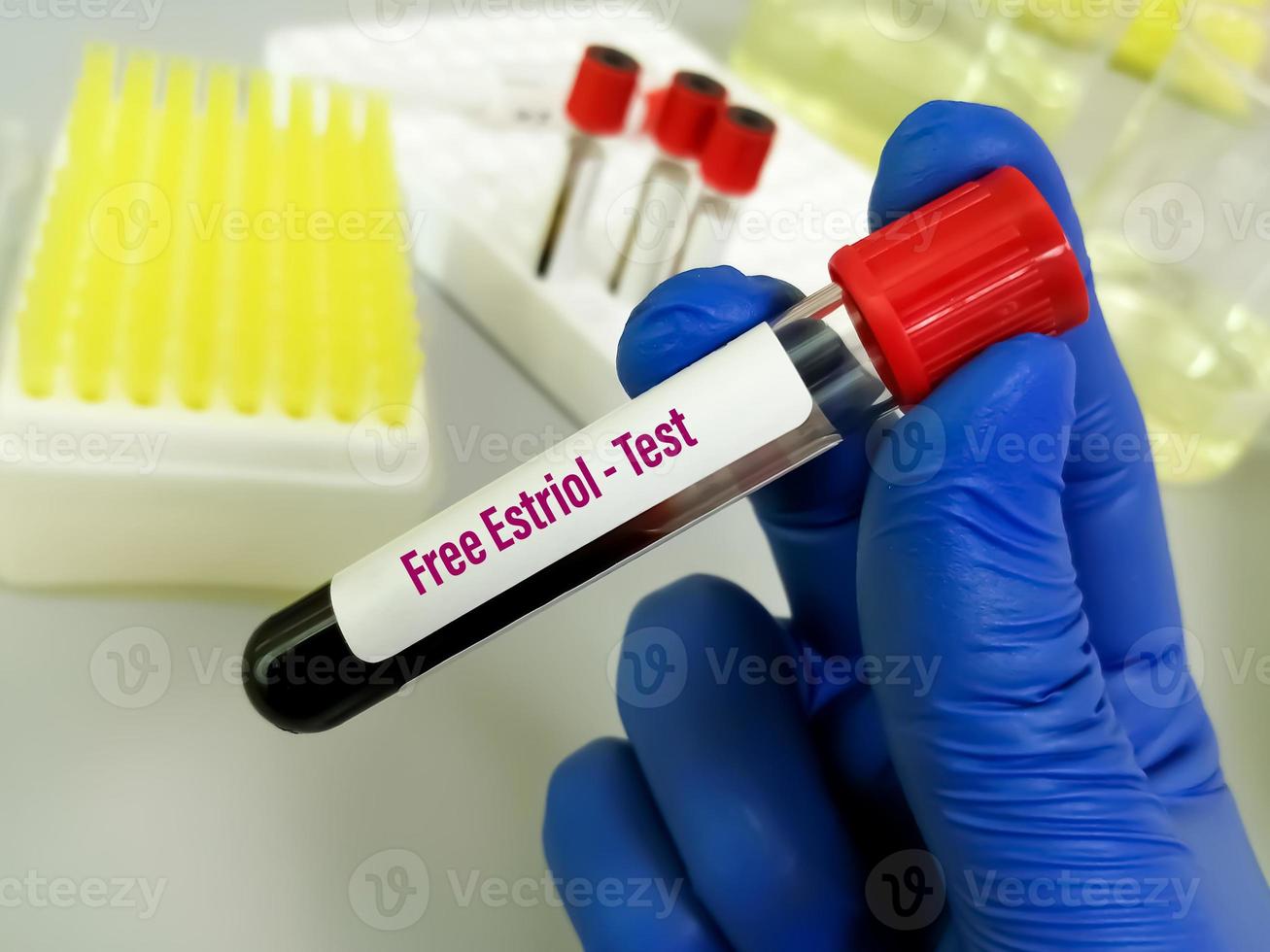 Blood sample for Free Estriol test in laboratory. 8931023 Stock Photo