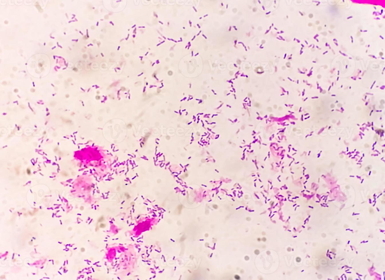 Gram staining, also known as Gram's method, is a method of differentiating bacterial species into two large groups called Gram positive and Gram negative. photo