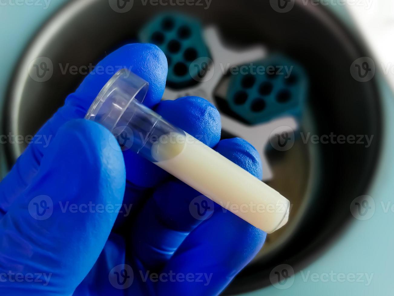 Medical scientist hold Lipemic blood sample in laboratory, high Triglyceride contain serum sample photo