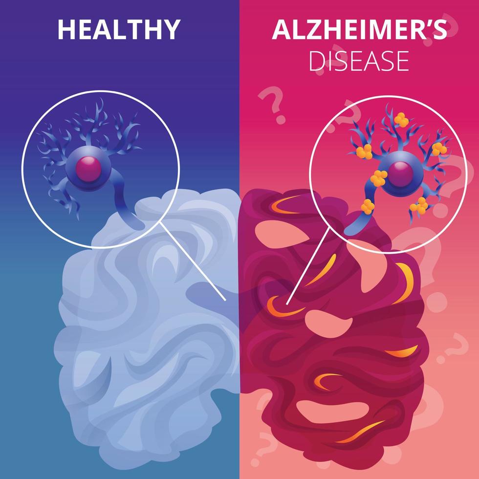 conjunto de banners de cerebro de alzheimer, estilo de dibujos animados vector