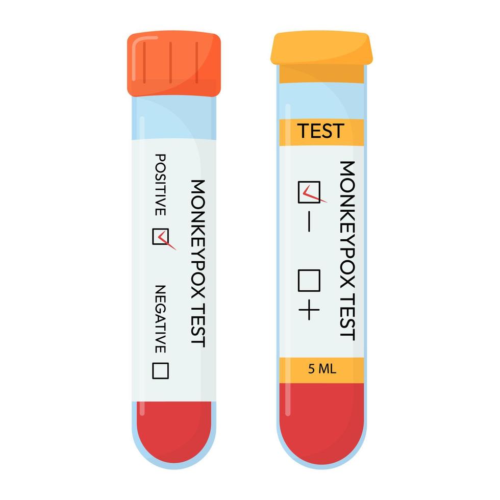 tubo de muestra de sangre para la prueba del virus de la viruela del mono. prueba positiva o negativa. sistemas de prueba. vector