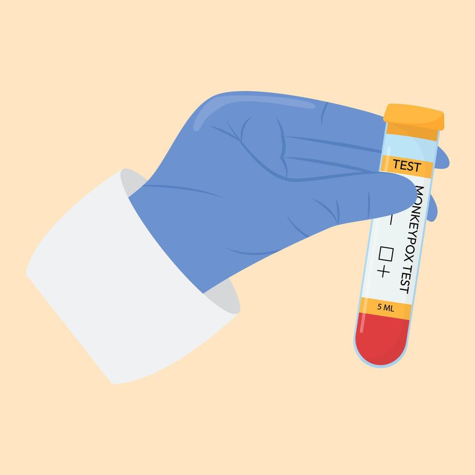 The hand of a doctor in a protective glove holds a test tube. Monkeypox virus test. Positive or negative test. Test systems. vector