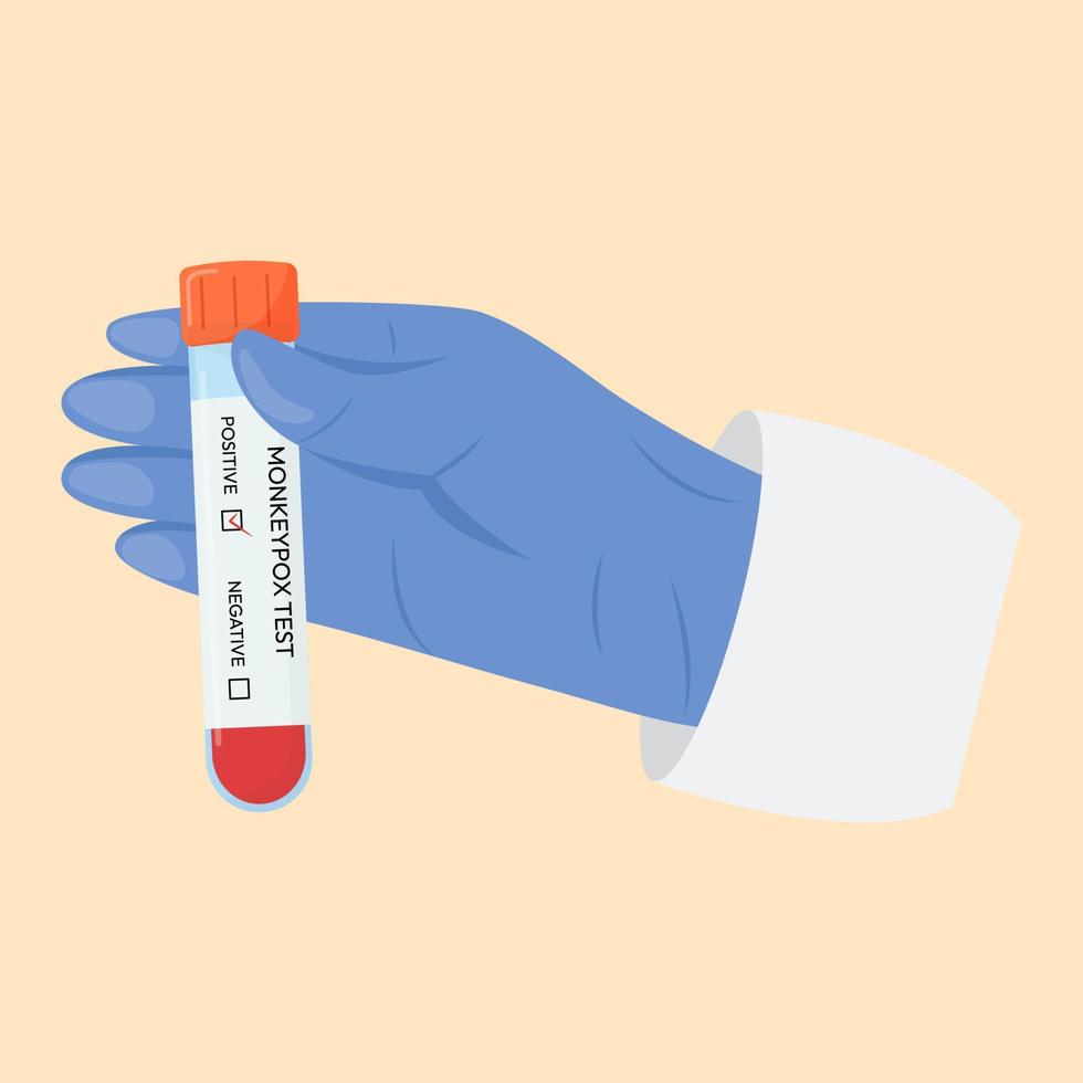 The hand of a doctor in a protective glove holds a test tube. Monkeypox virus test. Positive or negative test. Test systems. vector