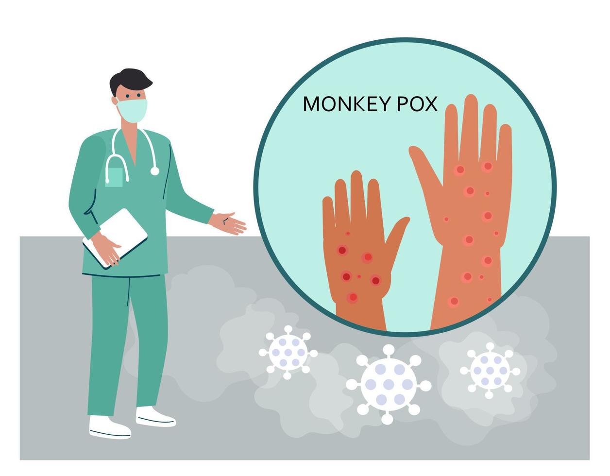 Monkeypox symptoms concept cartoon vector illustration