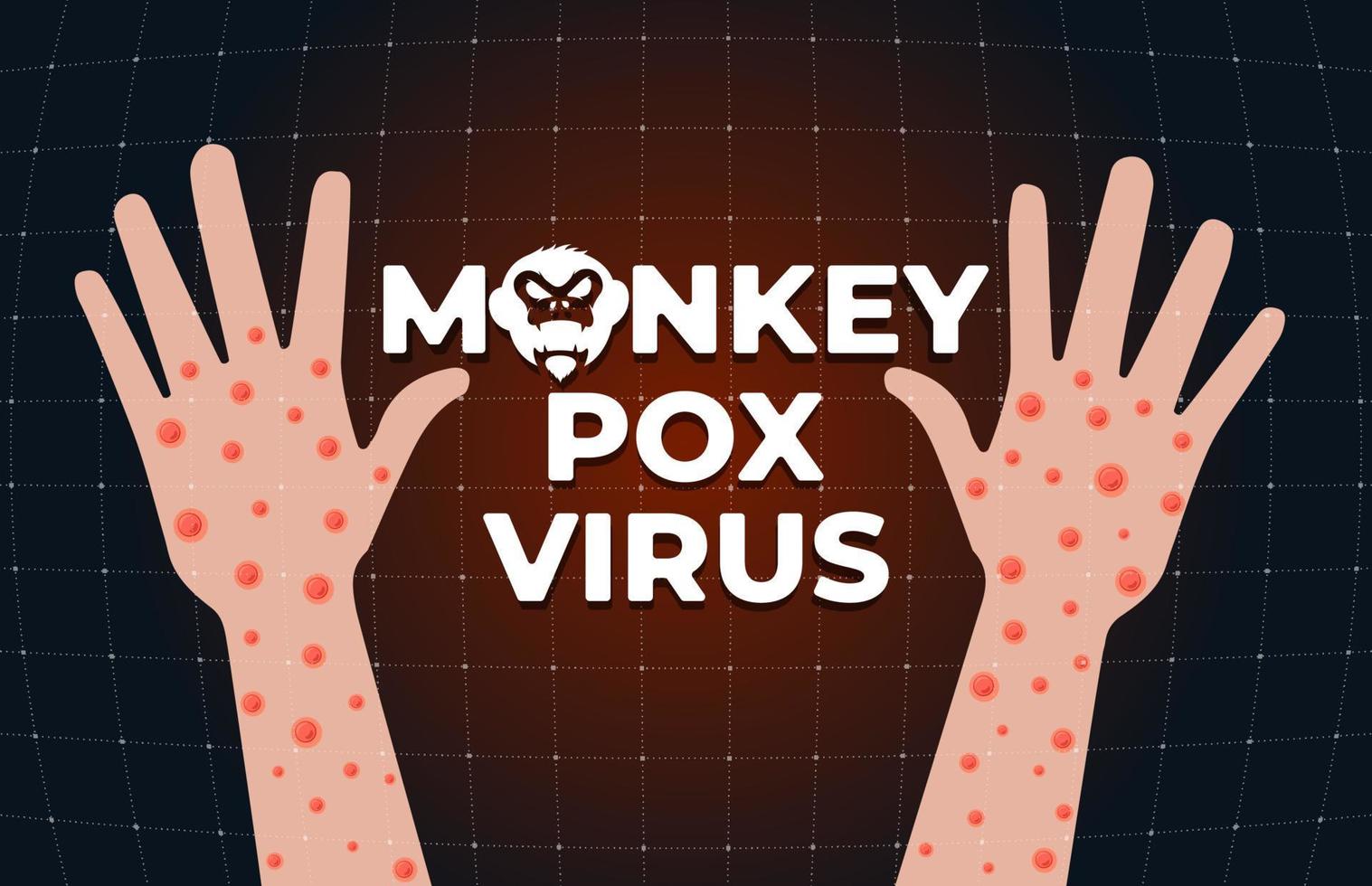 infección por el virus de la viruela del mono en el concepto de banner de mano. brote de la enfermedad de la viruela del mono ampollas y erupciones en la piel del brazo. mpv mpvx peligro y riesgo de epidemia de salud pública. síntoma de la enfermedad de la viruela. vector