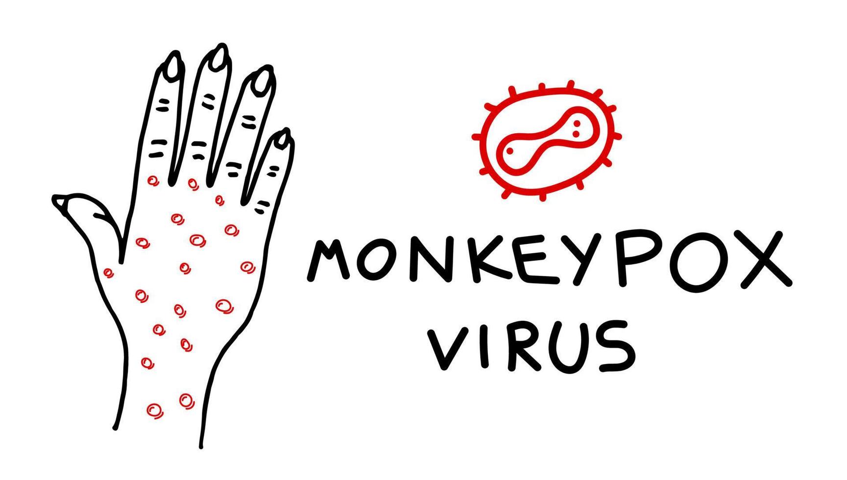 infección por el virus de la viruela del mono en el concepto de banner de dibujo a mano. brote de la enfermedad de la viruela del mono ampollas y erupciones en la piel de las manos. mpv mpvx peligro y riesgo de epidemia de salud pública. vector eps ilustración lineal