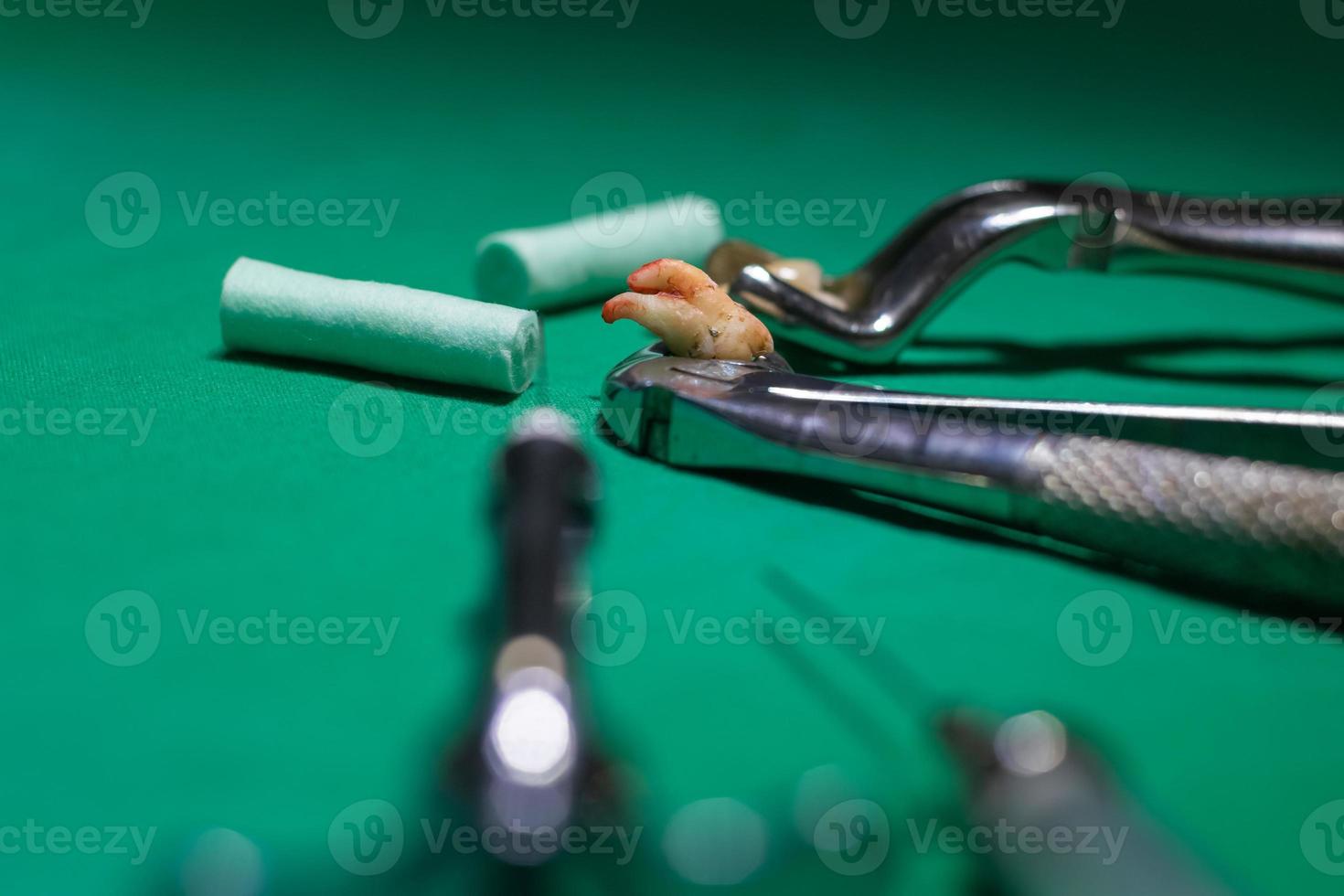 a pulled tooth at the dentist photo