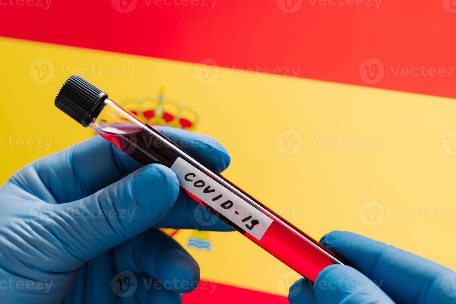 Infected blood sample in tube against Spain flag background. Coronavirus outbreak in Europe. Virus testing concept. Medical research, diagnosis photo