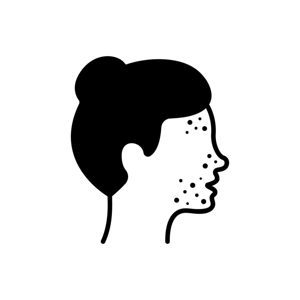 chica con espinillas en el icono de la silueta de la cara. mujer con espinilla, acné, pictograma de erupción. problema dermatológico, alergia, inflamación piel icono negro. ilustración vectorial aislada. vector