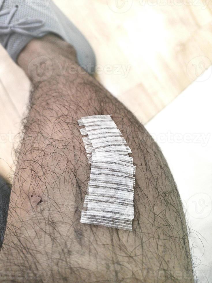 adhesive bandage on the lower leg photo