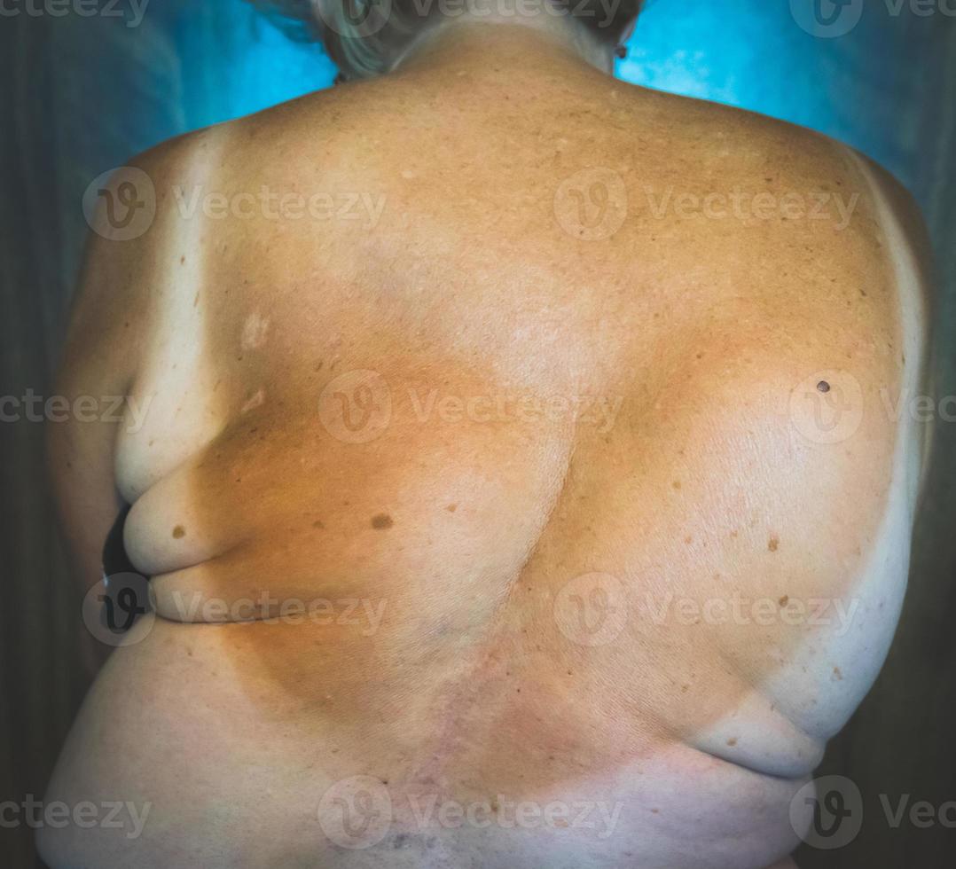 Womans back problem photo