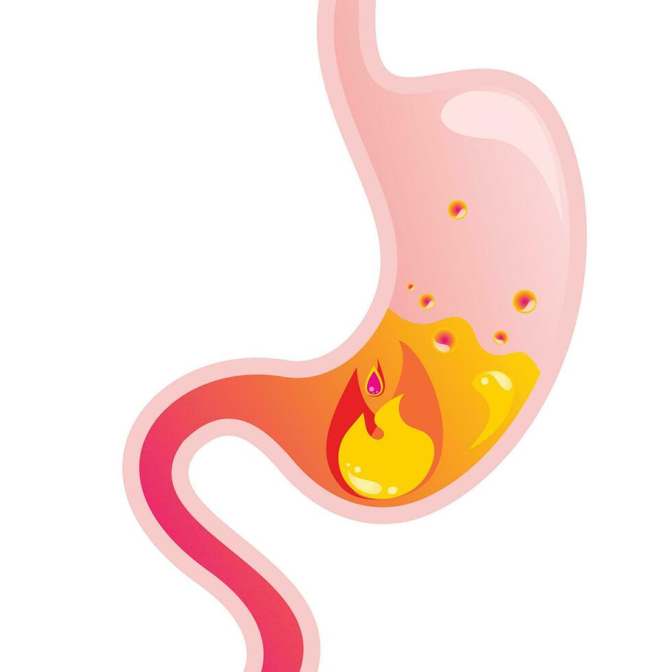 ilustración de vector de dibujos animados de ácido estomacal