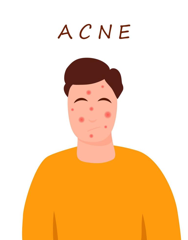 personaje adolescente de dibujos animados con piel de acné. concepto de problemas de piel. Ilustración de vector colorido aislado sobre fondo blanco. medicina y cuidado de la salud.