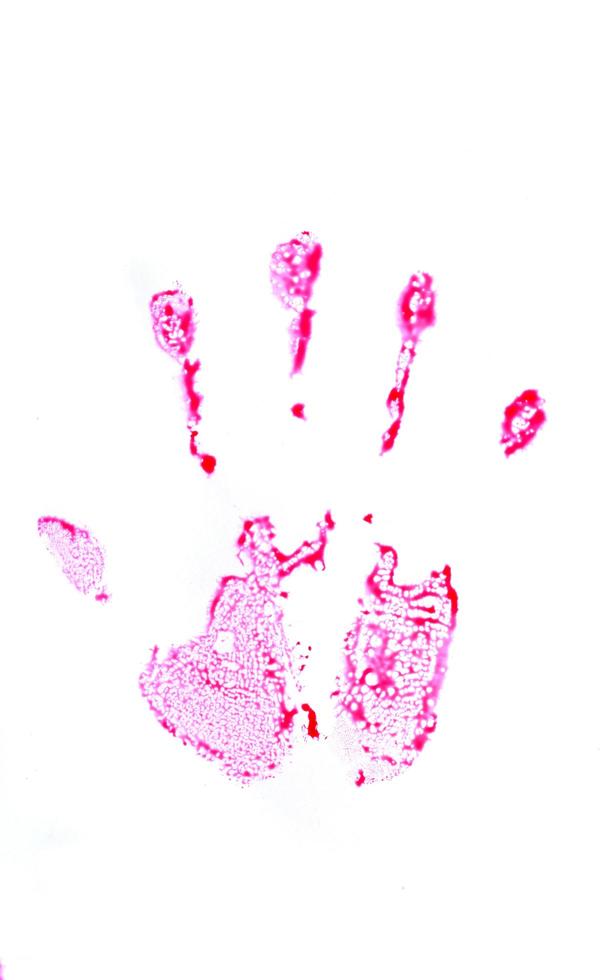 Blood stains isolated on white background photo