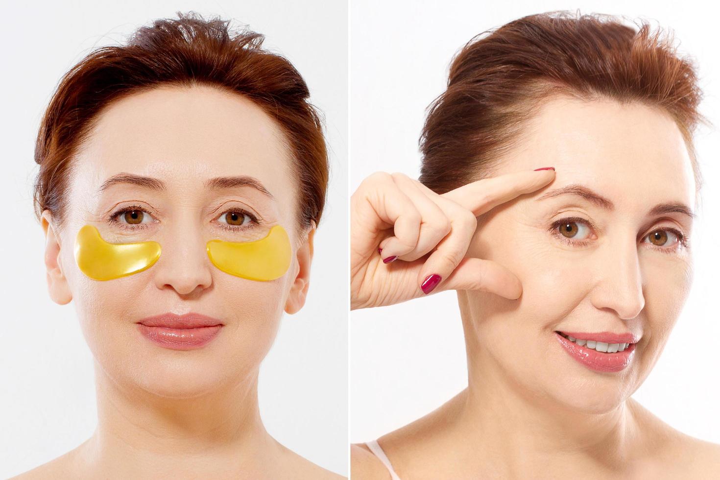 Macro female face before after beauty treatment. Middle aged woman. Beauty portrait of middle age woman with wrinkles and a gold patch under eye isolated. Collagen mask, spa concept. Summer skin care photo