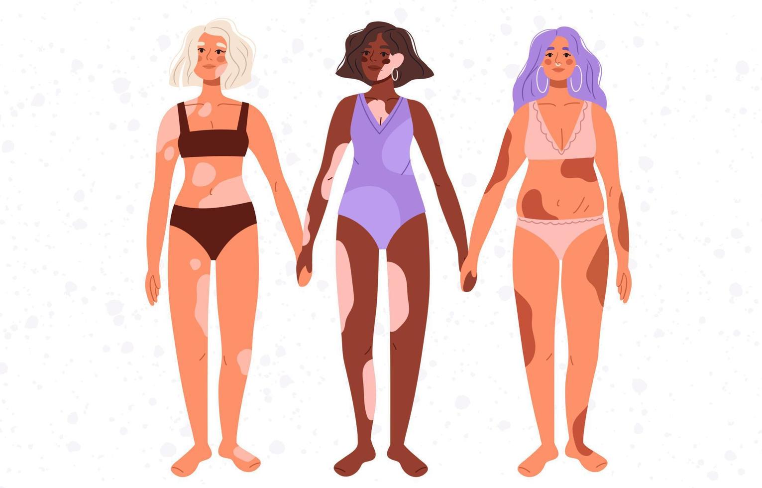 diversas mujeres multirraciales modernas con conjunto de vitíligo. tipo de figura femenina diferente en trajes de baño de pie en fila. diferentes conjuntos de mujeres positivas para el cuerpo. día mundial del vitíligo. ilustraciones de vectores planos