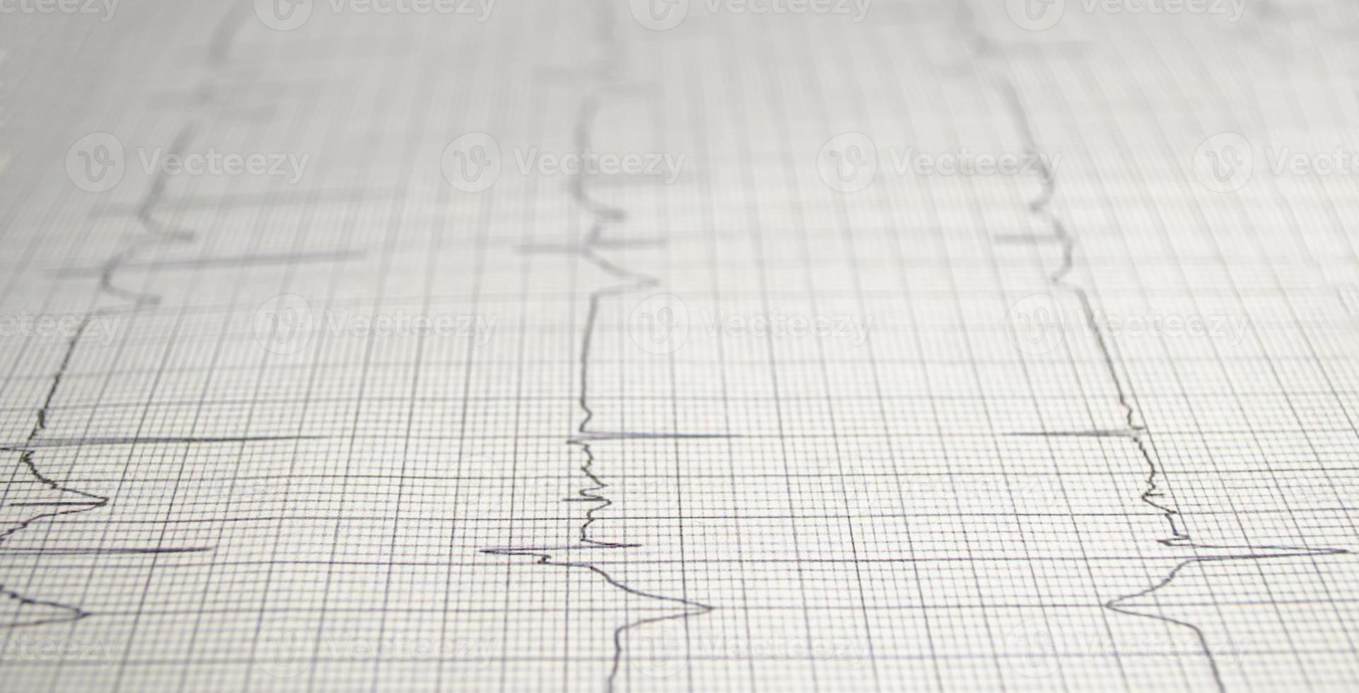 gráfico de cardiograma con primer plano de la mesa médica, para el registro cardíaco del cirujano, enfoque selectivo foto