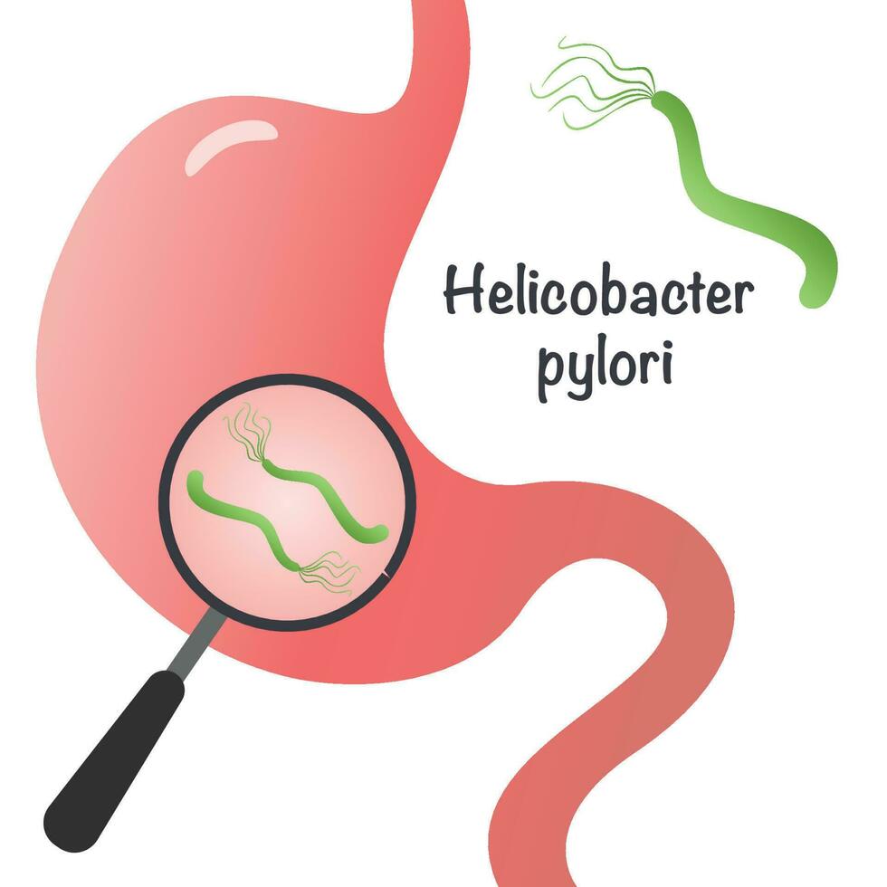 Vector Illustration Graphic of Helicobacter Pylori