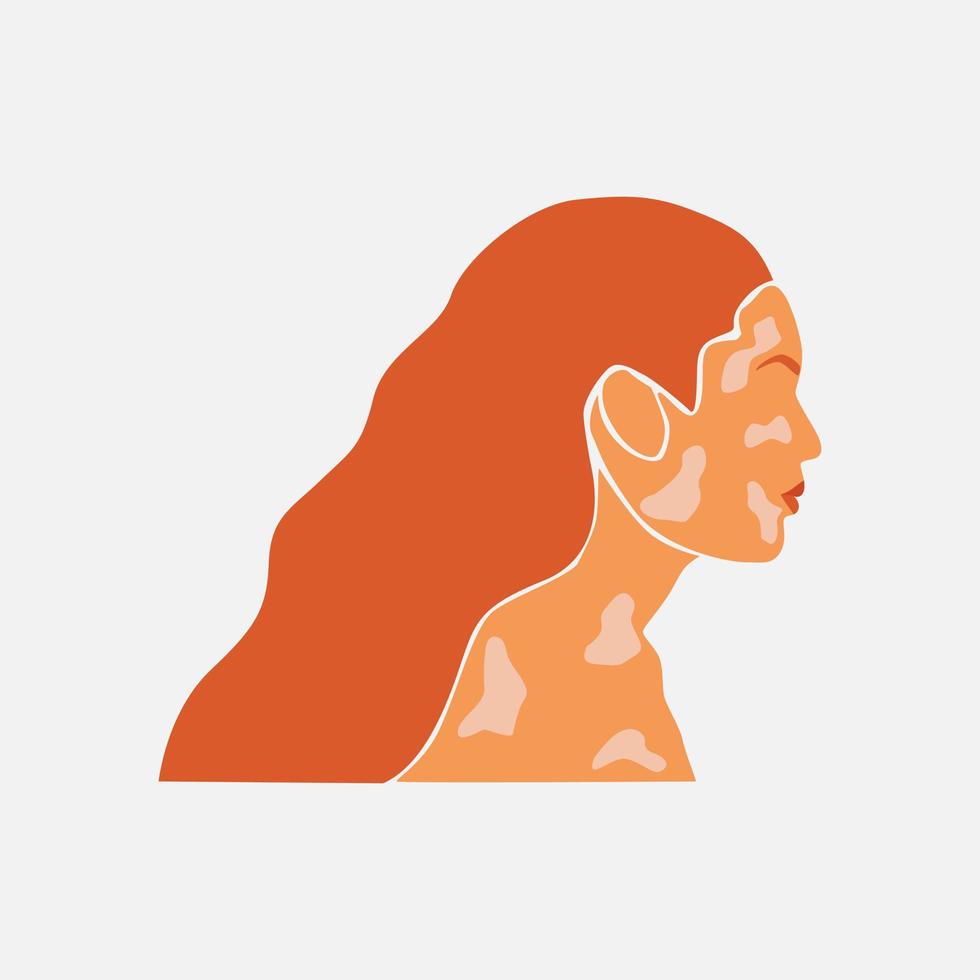 Abstract silhouette of beauty redhead woman with white pigmentation . Support awareness about chronic skin disorder. World Vitiligo day. Diversity tolerance. Fashion paper cut illustration vector