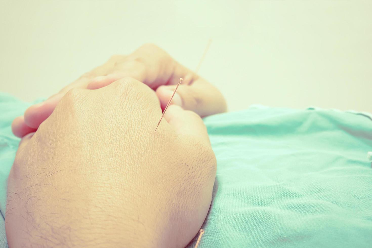 foto de estilo antiguo de un hombre asiático que está recibiendo tratamiento de acupuntura. primer plano en su mano.