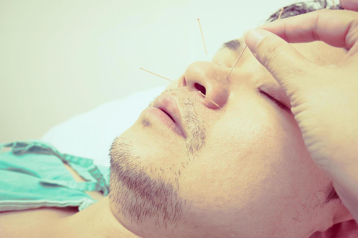 foto de estilo vintage de un hombre asiático enfocado selectivo que está recibiendo tratamiento de acupuntura