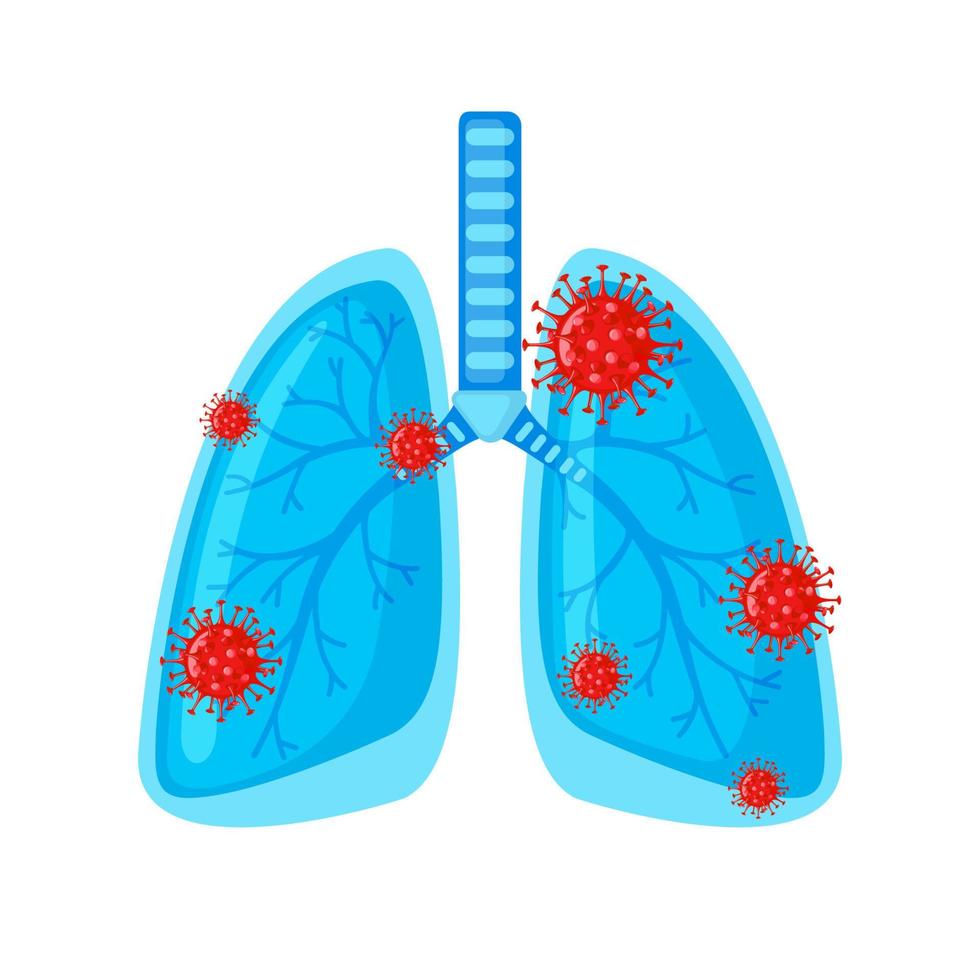 Human lungs icon with Coronavirus Bacteria in flat style isolated on white background. Covid-19 in the lung. The coronavirus causes the severe illness SARS . Vector illustration.