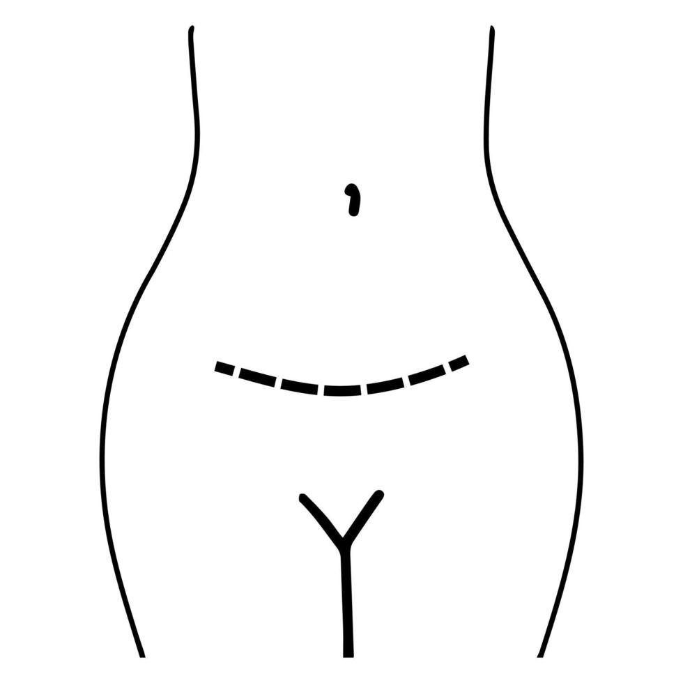 Gynecological surgery, problem with reproductive system. Thin line icon. vector